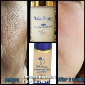 Improving foundation.